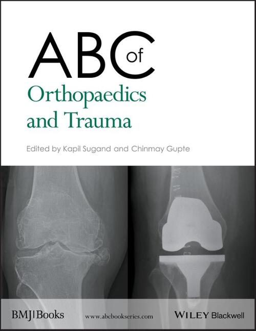 ABC of Orthopaedics and Trauma