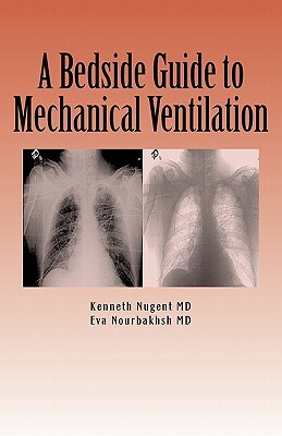 Bedside Guide To Mechanical Ventilation
