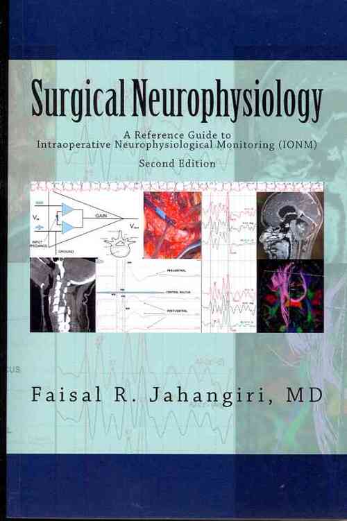 Surgical Neurophysiology - 2nd Edition: A Reference Guide to Intraoperative Neurophysiological Monitoring