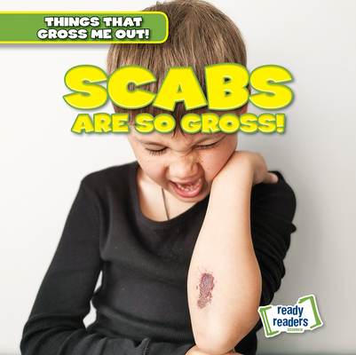 Scabs Are So Gross!