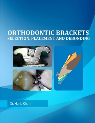 Orthodontic Brackets: Selection, Placement and Debonding
