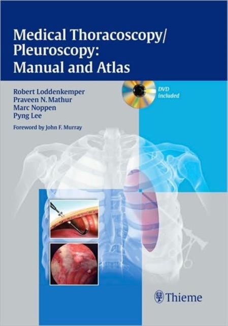 Medical Thoracoscopy / Pleuroscopy: Manual and Atlas