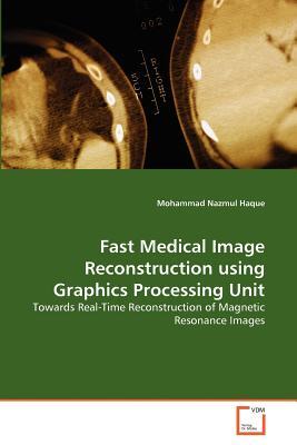 Fast Medical Image Segmentation Fast Medical Image Reconstruction using Graphics Processing Unit, VDM ...