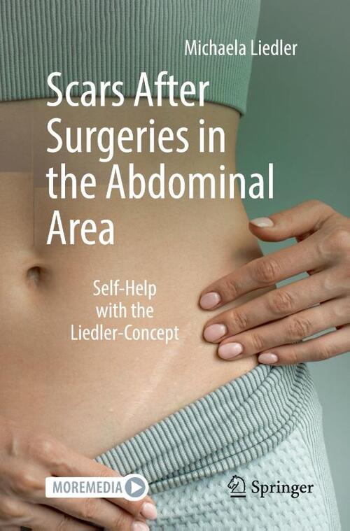 Scars After Surgeries in the Abdominal Area