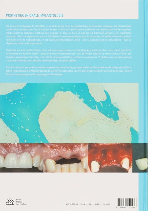Prothetiek en orale implantologie