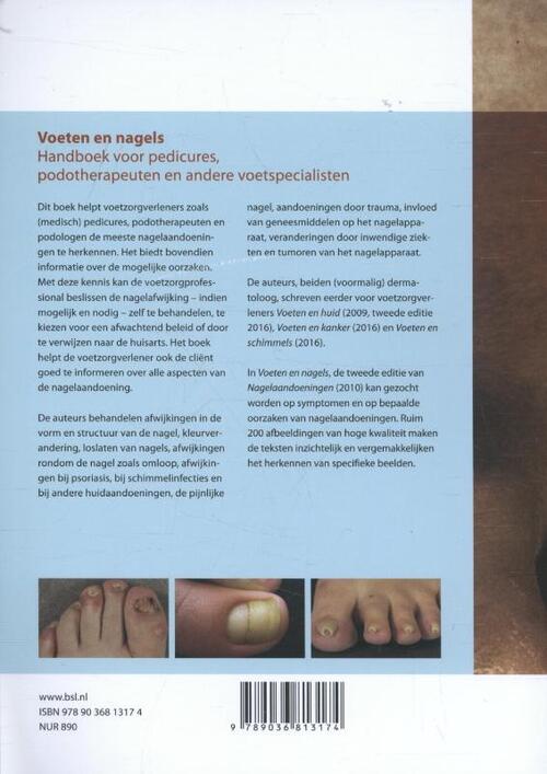 Voeten en nagels