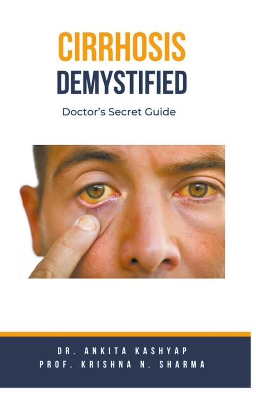 Cirrhosis Demystified