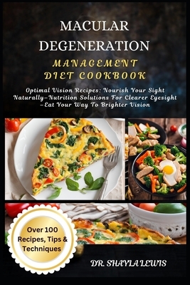 Macular Degeneration Management Diet Cookbook: Optimal Vision Recipes: Nourish Your Sight Naturally-Nutrition Solutions For Clearer Eyesight -Eat Your