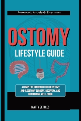 The Ostomy Lifestyle Guide: A Complete Handbook for Colostomy and Ileostomy Surgery, Recovery, and Nutritional Well-Being