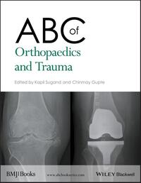 ABC of Orthopaedics and Trauma