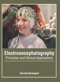 Electroencephalography: Principles and Clinical Applications