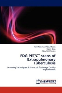 FDG PET/CT scans of Extrapulmonary Tuberculosis