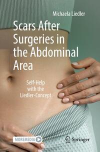 Scars After Surgeries in the Abdominal Area
