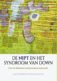 De NIPT en het syndroom van Down