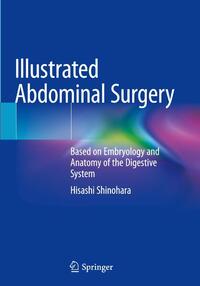 Illustrated Abdominal Surgery