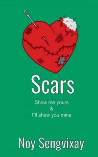 Scars