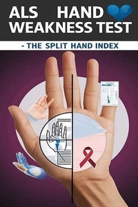 ALS Hand Weakness Test - The Split Hand Index: The split hand index might suggest hand weakness specifically due to ALS. But is it enough to make a di