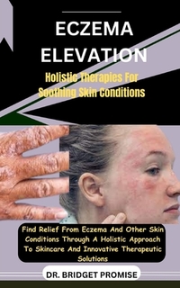 Eczema Elevation: Holistic Therapies For Soothing Skin Conditions: Find Relief From Eczema And Other Skin Conditions Through A Holistic
